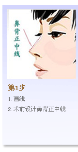 第一步