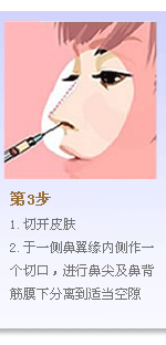 第3步