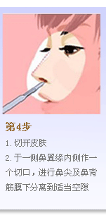 第4步